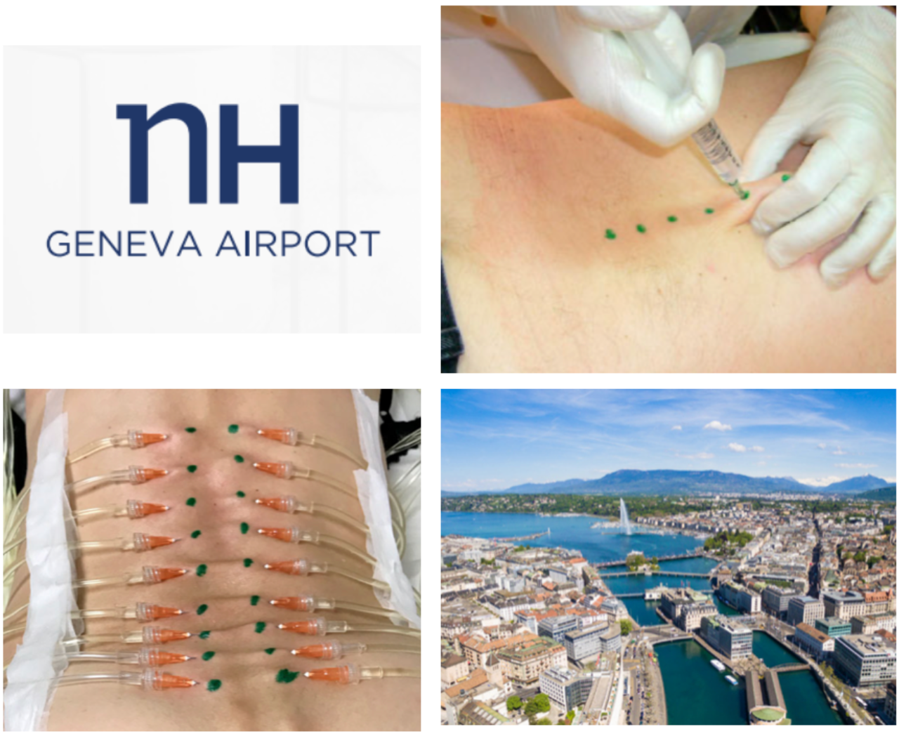 FORMATION COMPLÈTE À L’HYDROTOMIE PERCUTANÉE